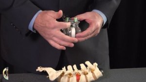 Хирургия фасеточных суставов поясничного отдела позвоночника