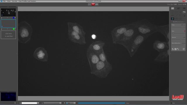 Gestion de la fluorescence avec le logiciel Gryphax de JENOPTIK