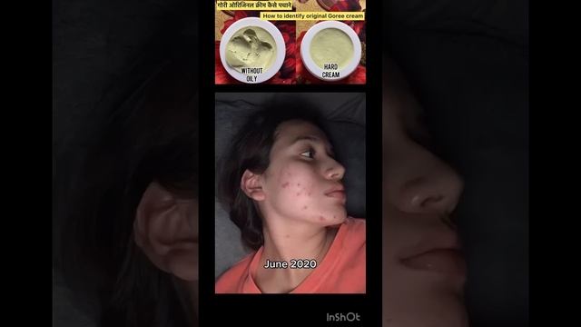 Goree cream | Goree whitening cream | pigmentation cream | dark spots remove cream |#shortvideo