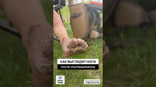 Как выглядят ноги после ультрамарафона 160.9 км