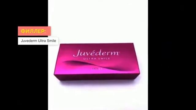 Филлеры Juvederm | 2filler.ru