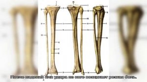 Перелом костей голени у детей