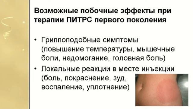 Лечение рассеянного склероза  Часть 1