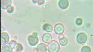 Коровье молоко под микроскопом