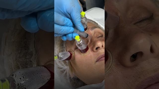 Вы знали❓ Чтобы записаться на обучение по хиджаме напишите по этому номеру: +79046689444 смотреть онлайн