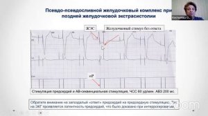 Основы электрокардиостимуляции: мостик к пониманию работы имплантируемых устройств