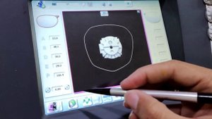 MONTAGEM DE ÓCULOS - DELTA 2 ESSILOR