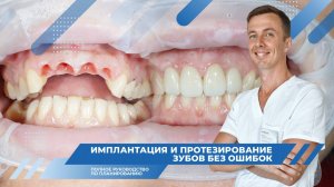 Имплантация и Протезирование Зубов без Ошибок: Полное руководство по планированию для Пациентов!
