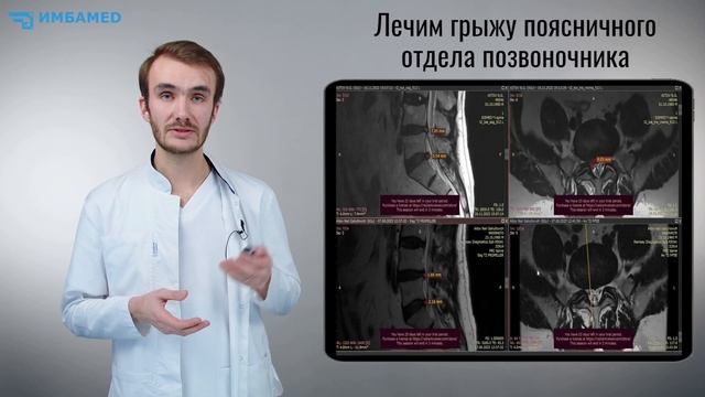 Результаты лечения межпозвонковых грыж в клинике Имбамед.