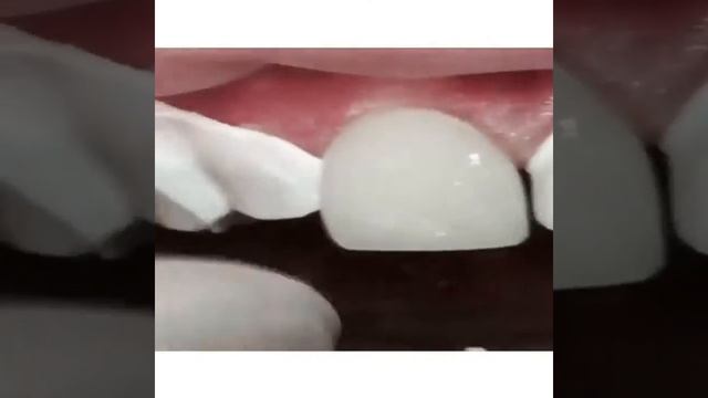 22 августа 2017 г. смотреть онлайн