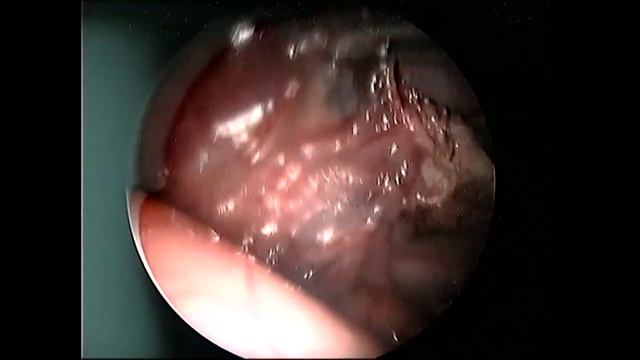 Лапароскопически-ассистированная спленэктомия у кошки | Laparoscopic-assisted splenectomy in a cat