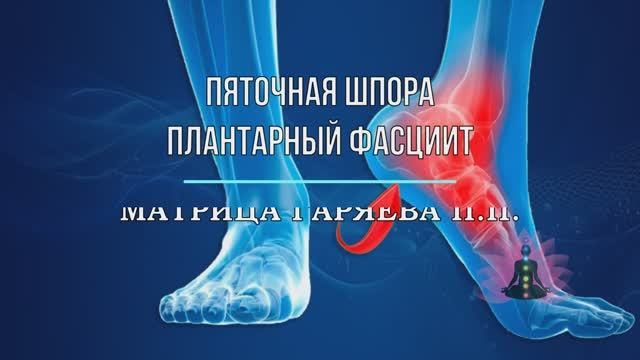 Матрица Гаряева*ПЯТОЧНАЯ ШПОРА*ПЛАНТАРНЫЙ ФАСЦИИТ