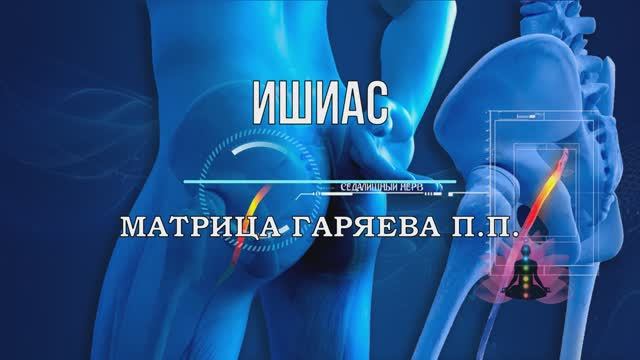 Матрица Гаряева*ИШИАС*НЕВРАЛГИЯ СЕДАЛИЩНОГО НЕРВА