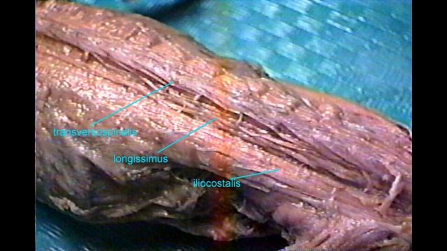 epaxial muscles in vertebrates