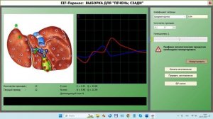 2024-07-24_191002-ПО Дианел®-2.1. обучение, EIF-перенос, создание инфоцевтиков, комбинация и запись