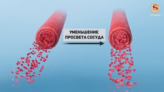 Хотите сладенького? Сахар. Всё про сахар. #сахар #просахар #ожирение #стопсахар #лишнийвес