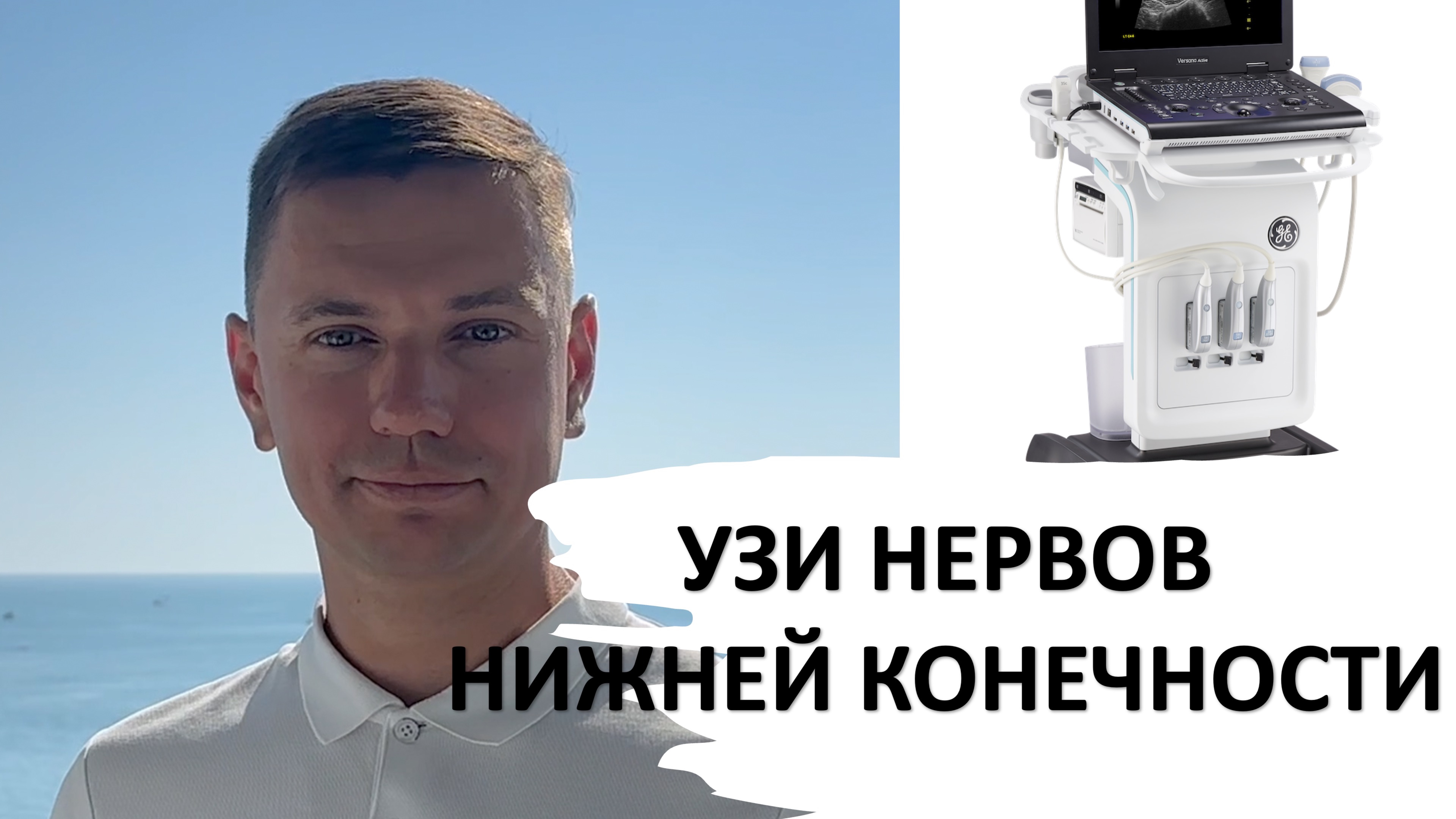 УЗИ НЕРВОВ НИЖНЕЙ КОНЕЧНОСТИ #узи #anatomy #ultrasound #нервы