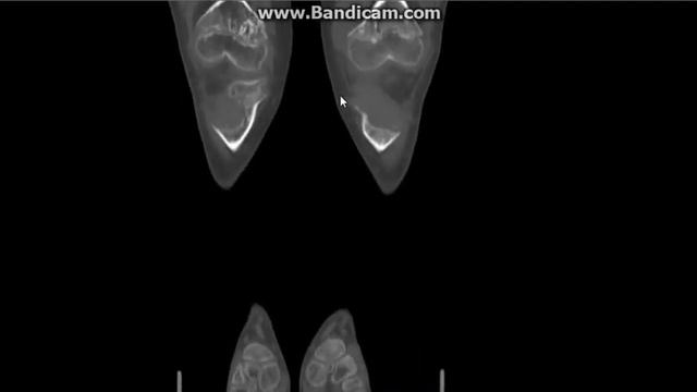 Radiology in clinical practice 26 Amr Saadawy смотреть онлайн