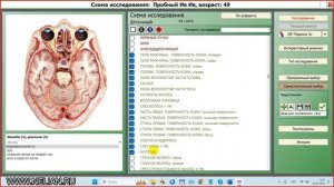 2024-07-30_121845-ПО Дианел®-2.1. Обучение, Схема исследования- Предустановки применение, дополнение