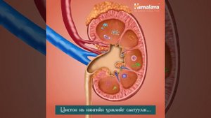 Цистон SVC