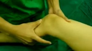 Положительный тест Lachman при хронической нестабильности коленного сустава