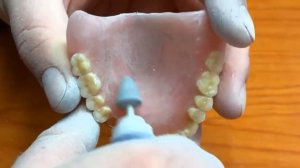 Акриловый съёмный протез , обработка  Зубной техник  Полировка   Villacryl