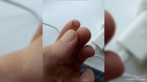 Я мобик моё ранение за защиту родены Сво