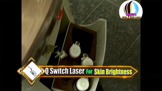 Q Switch laser- Best Treatment for Pigmentation, Skin brightness, Acne, Melasma, tattoo removal