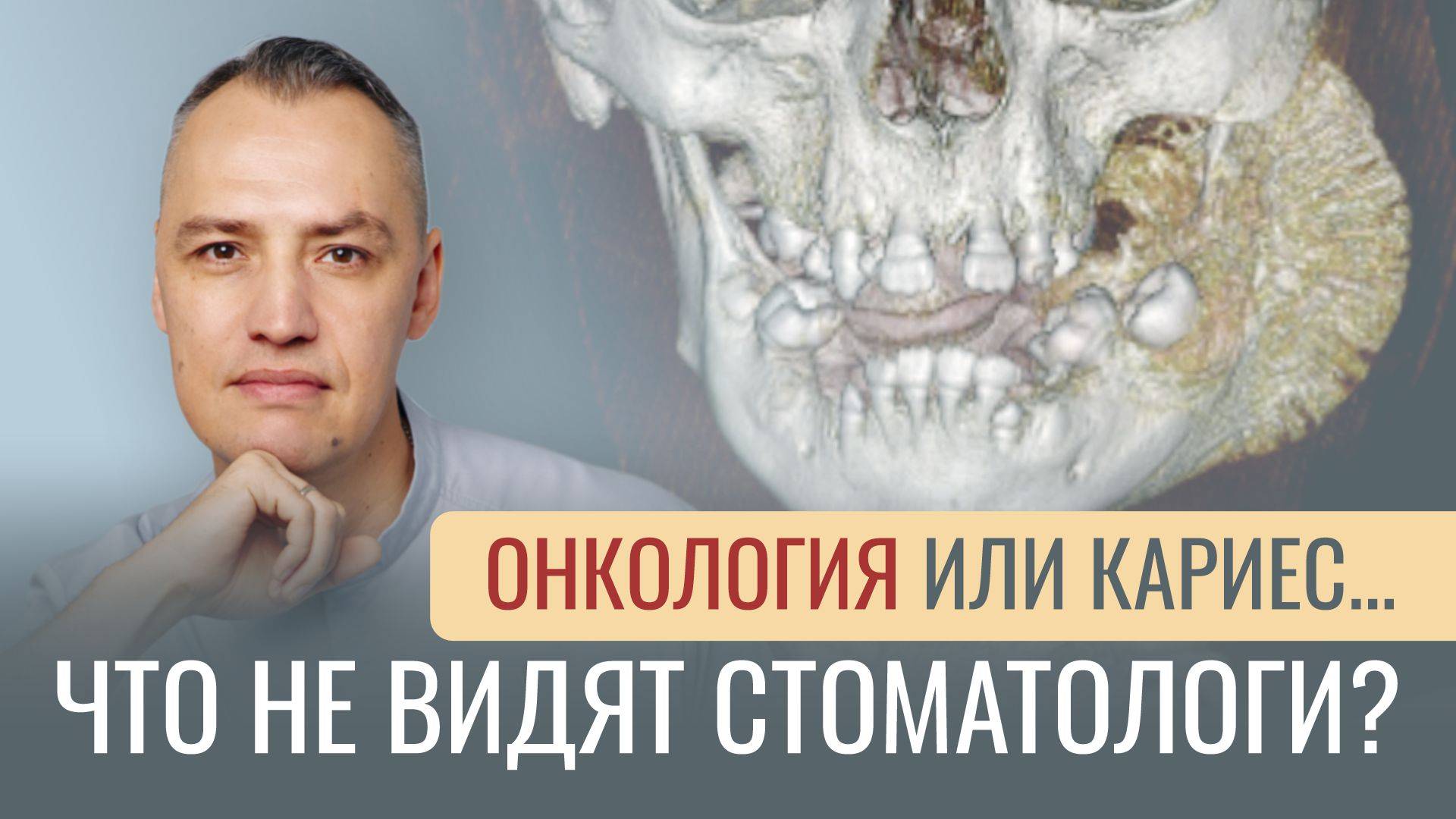 ОНКОЛОГИЯ ИЛИ КАРИЕС... Что не видят стоматологи?