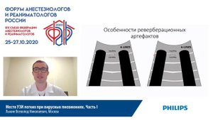 УЗИ легких при вирусных пневмониях I часть Лыхин В.Н.ФАР 2020