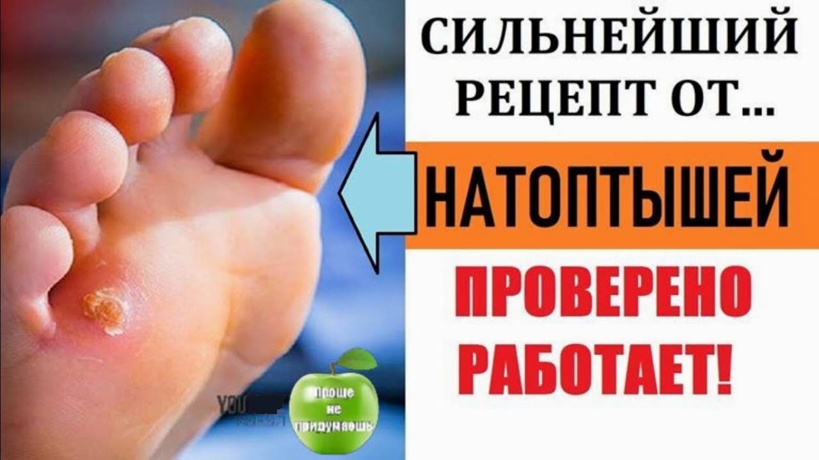 Как избавиться от натоптышей - Эффективный и Абсолютно бюджетный рецепт. смотреть онлайн