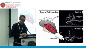 Ультразвуковая оценка волемического статуса. Лыхин В.Н 2018