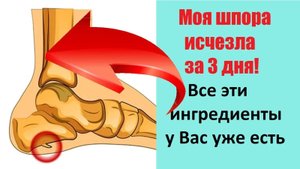 Моя шпора исчезла за 3 дня. Все эти ингредиенты у Вас уже есть
