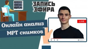 Как избежать распространенных ошибок при лечении боли в спине?