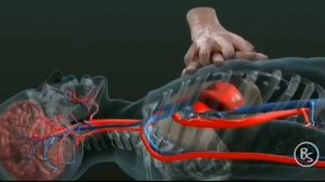 Сердечно лёгочная реанимация, Сердечно лёгочно мозговая реанимация..