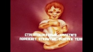 Гнойничковые заболевания кожи (СССР, 1982 г.) оцифровка 8-мм. киноплёнки