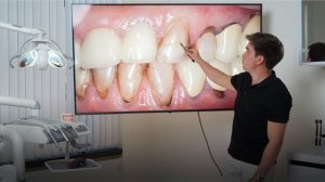 Зубы Поменяли Жизнь! ДО и ПОСЛЕ - Реальный Случай