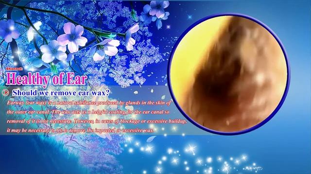 Cholesteatoma/Холестеатома #47 смотреть онлайн