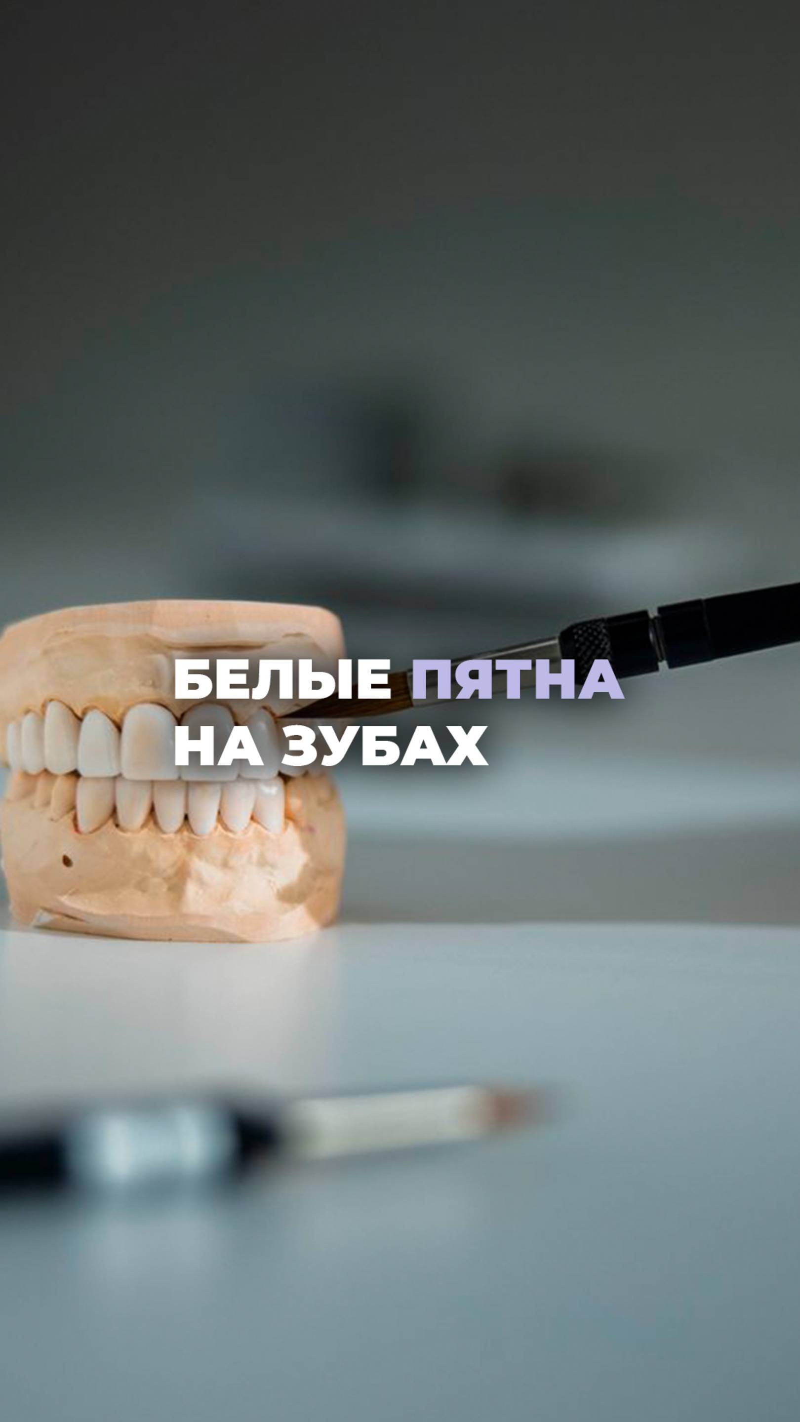 Белые пятна на зубах