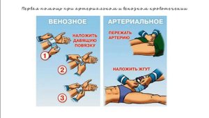 5. Первая помощь при кровотечениях
