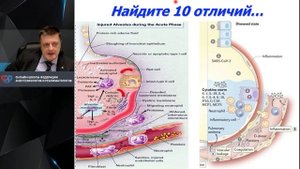 Показания для инвазивной ИВЛ COVID-19 Лебединский К.М.
