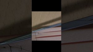 Техника наложения швов Донати, Альговера, Z-образного и П-образного