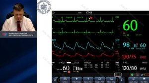 Мониторинг релаксантов Лебединский К.М