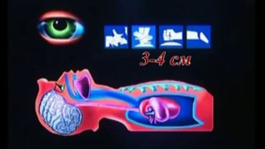 3. Оказание первой помощи при клинической смерти