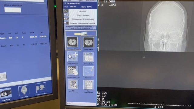 Компьютерная томография височных костей
Обучение 
Кт оборудования GE OPTIMA