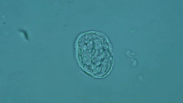 Dermatology. Molluscum contagiosum.