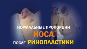 Ринопластика: от гипса до уверенности