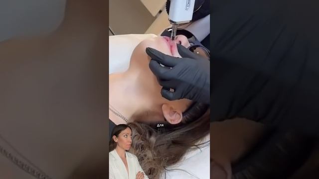 Как увеличить губы без инъекций #обучениекосметологов #губымосква