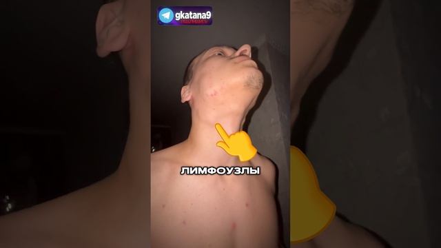 📛🚑 КАК ЗА 1 ДЕНЬ МЕНЯ ПОЛОЖИЛИ В БОЛЬНИЦУ смотреть онлайн
