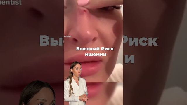 Безоперационная ринопластика #ринопластика #ринопластикамосква #косметологмосква
